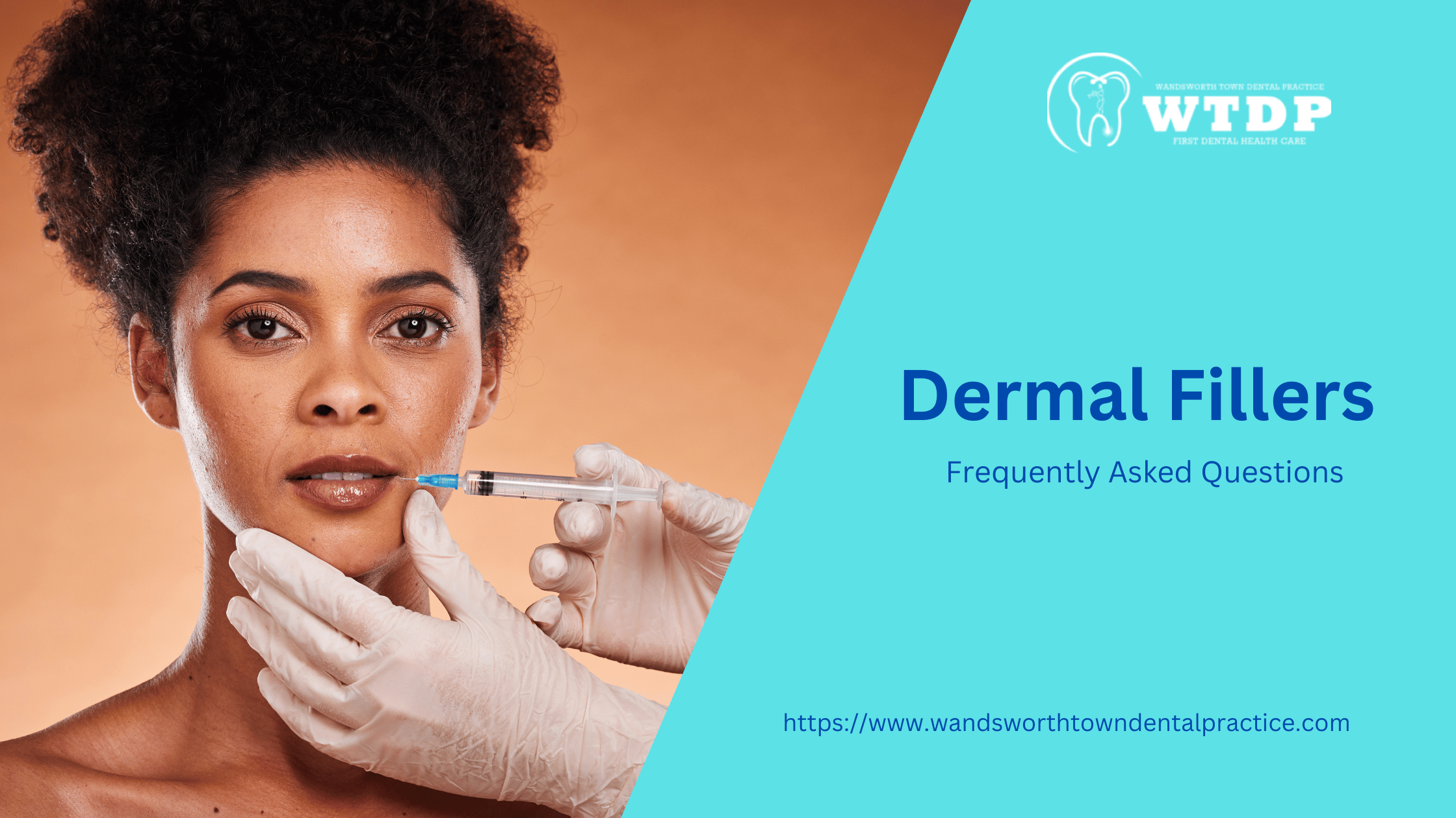 Dermal Fillers - Frequently Asked Questions - Wandsworth Town Dental ...