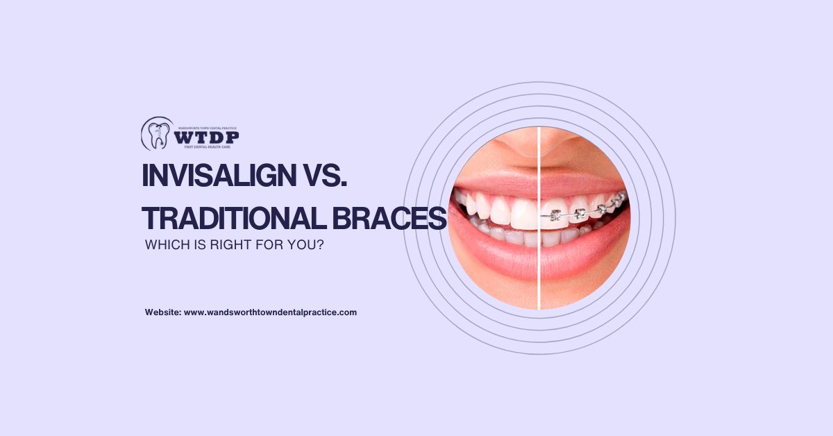 Invisalign vs. Traditional Braces: Which Is Right for You?