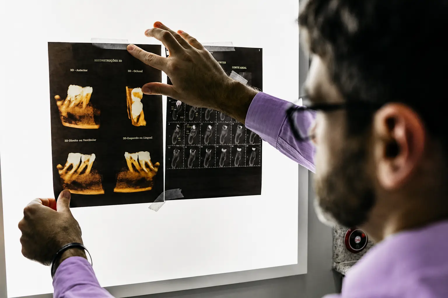 Dental implants