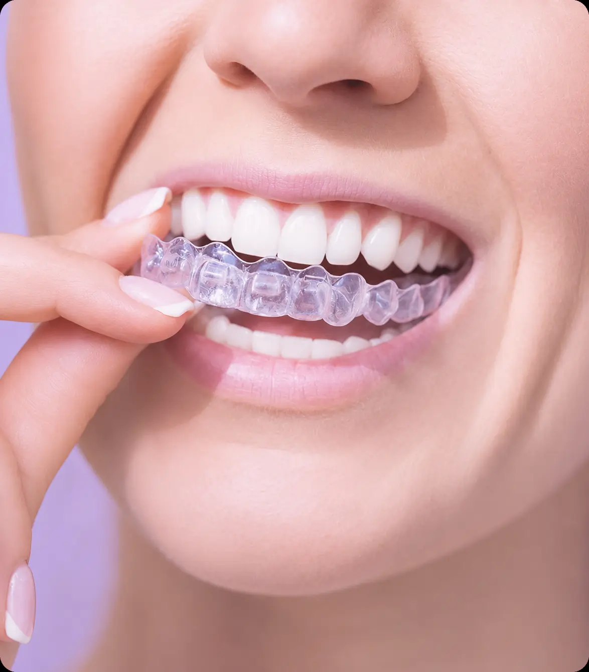Invisalign