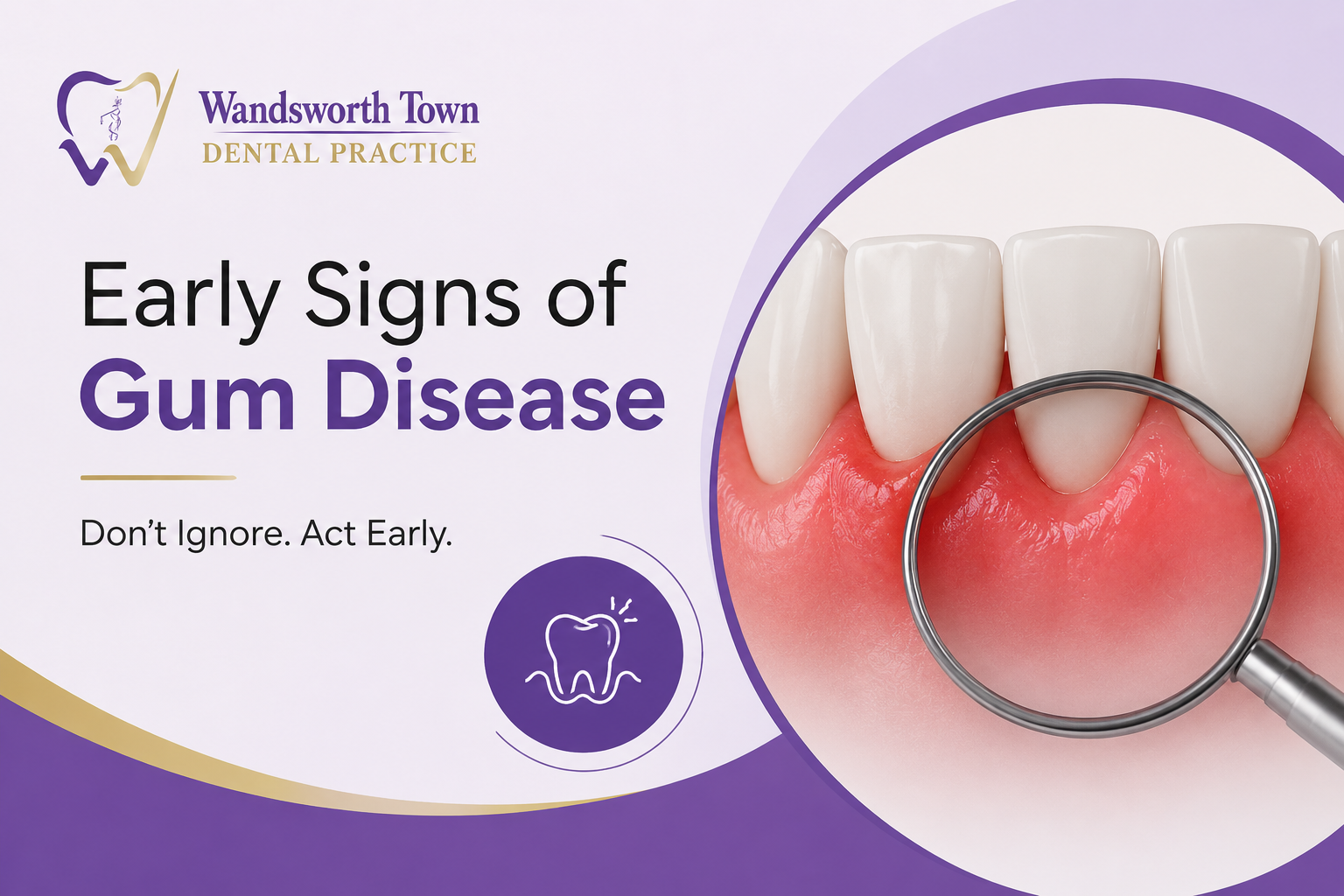 Early Signs of Gum Disease