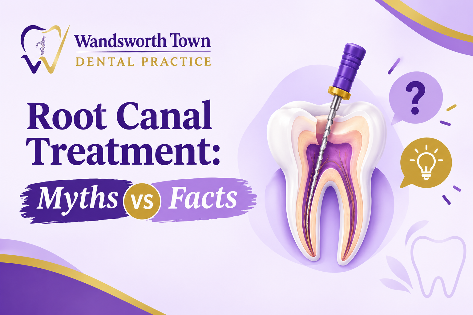Root canal treatment consultation at Wandsworth Town Dental Practice