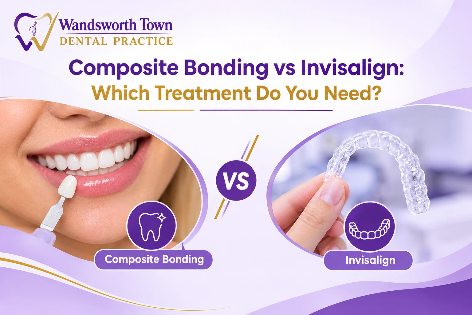 Composite bonding vs Invisalign treatment in Wandsworth